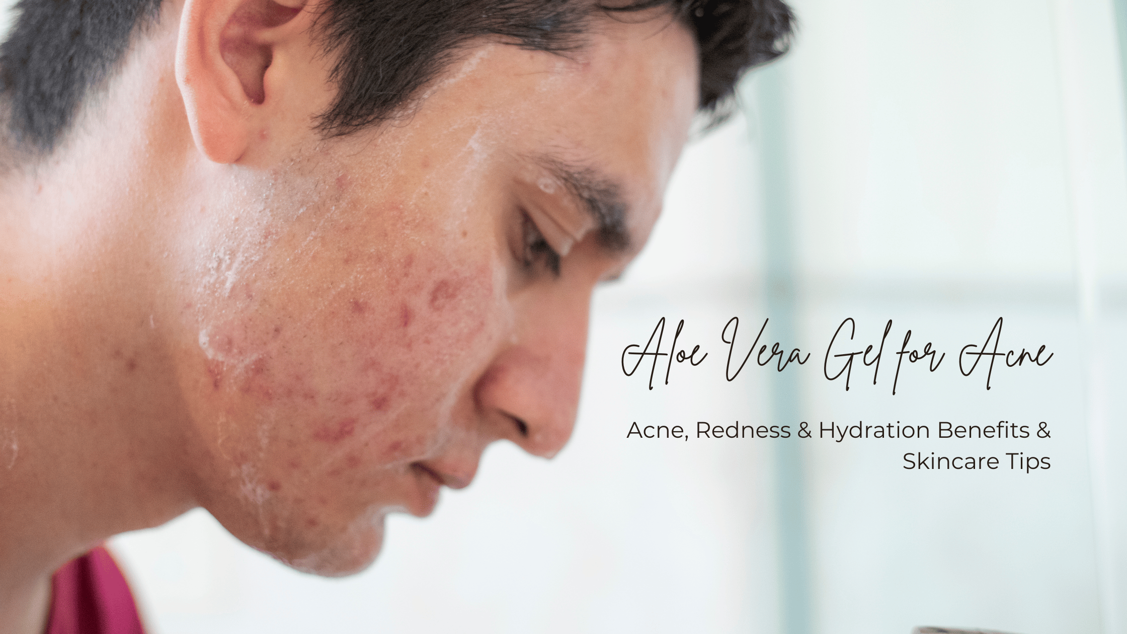 Aloe Vera Gel for Face: Acne, Redness & Hydration Benefits & Skincare Tips